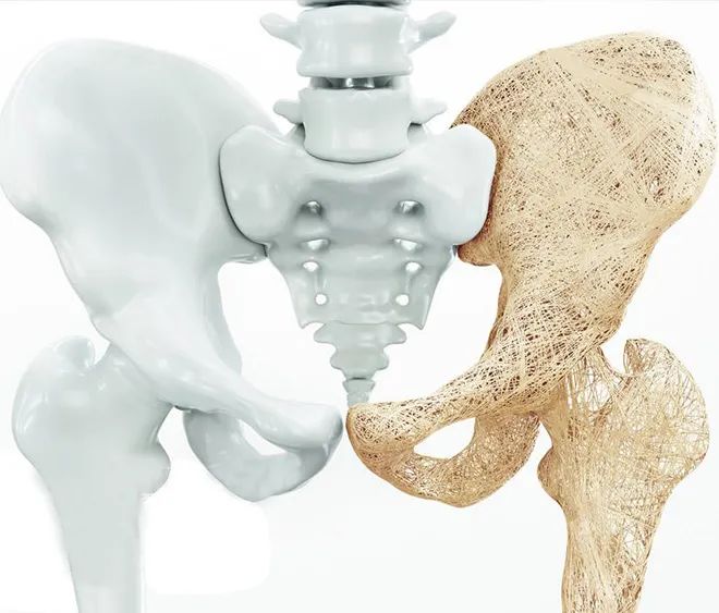 Anti-osteoporosis